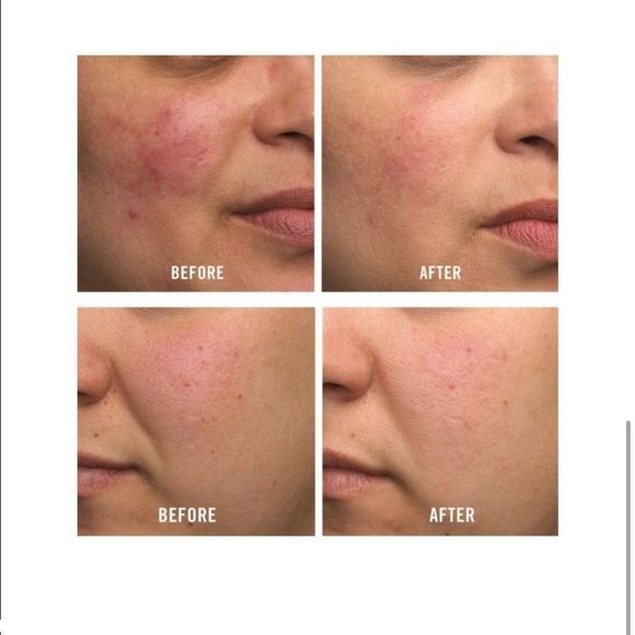 $4 🌙 First Aid Beauty Ultra Repair Cream NEW - Picture 4 of 7